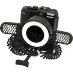 Doctors Eyes Professional System with 72mm LED Ring Light & Wing Light