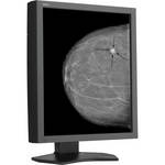 NEC 21" Grayscale 5-Megapixel Medical Diagnostic Monitor