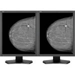 NEC 21.3" Grayscale 5-Megapixel Medical Diagnostic Monitors with Graphics Card (2)