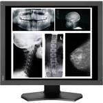 NEC MultiSync MD215MG 21.3" Grayscale 5 Mp Medical Diagnostic Monitor