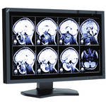 NEC 24"MEDICL LED BCKLT MNTR w/FRONT SENSR