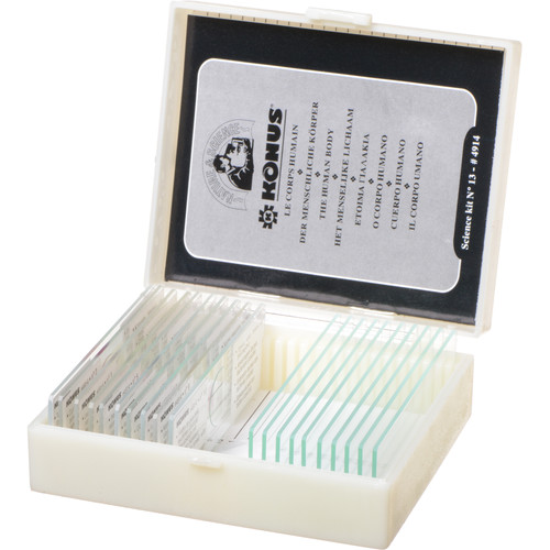 Konus #4914 Biology 2 Slide Set: Human Tissue with Pathology Part I (10 Slides)