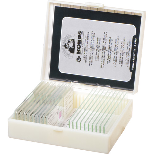 Konus #4915 Biology 2 Slide Set: Human Tissue with Pathology Part II (10 Slides)